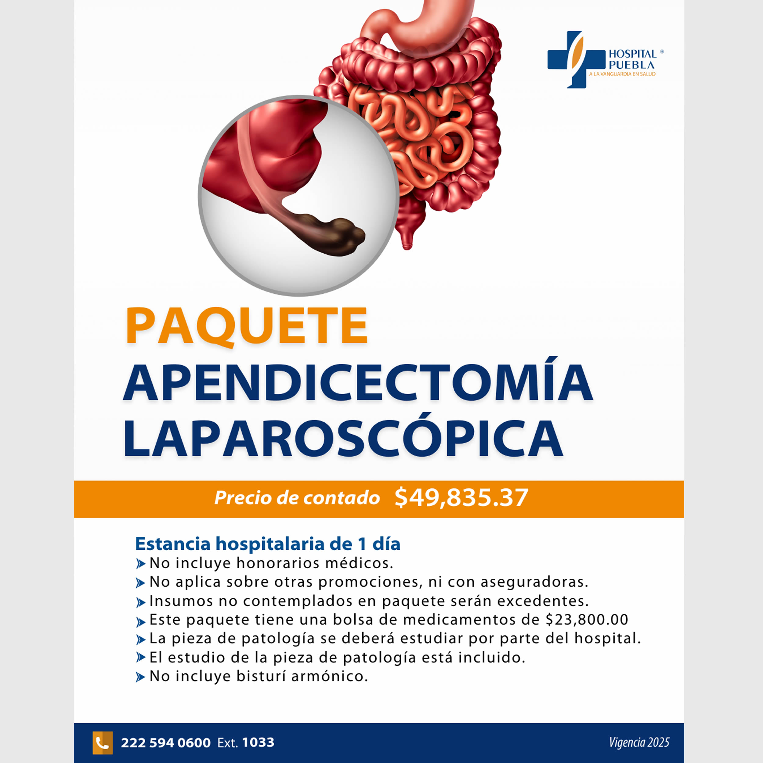 Paquete de Apendicetomía Laparoscópica